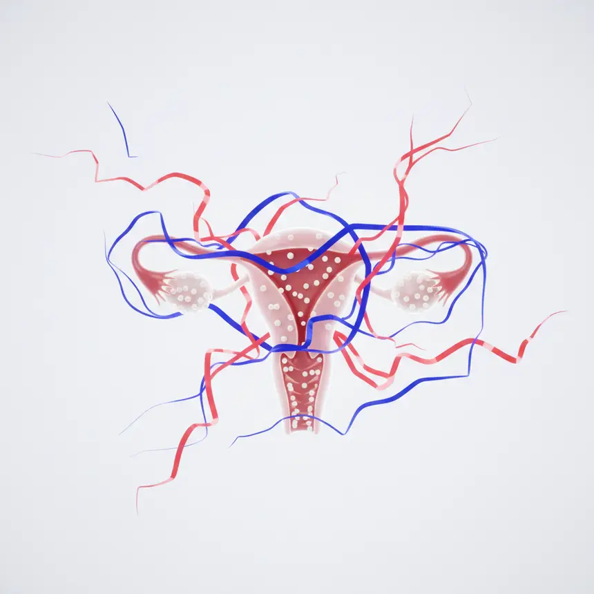 Ovarian hormonal imbalance